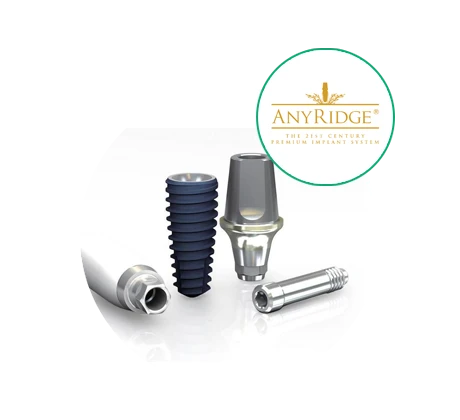 anyridge имплант